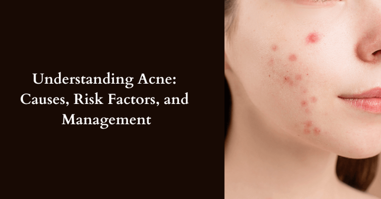 What are the main causes of acne