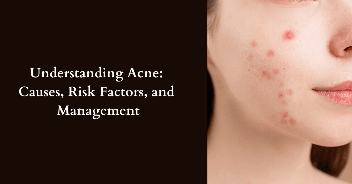 Read more about the article What are the Main Causes of acne? A Breakdown of the Key Factors